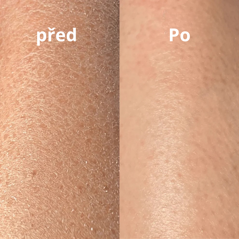 Luva Esfoliante Yuna