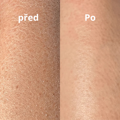 Luva Esfoliante Yuna